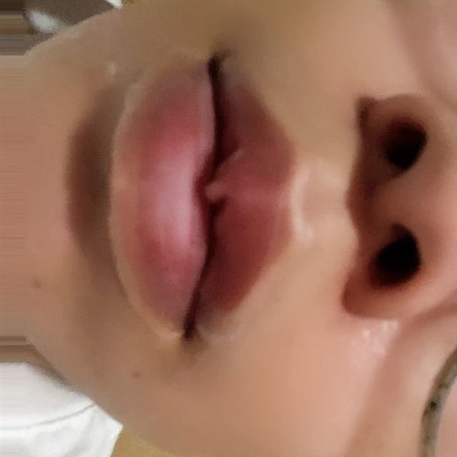 a*****a